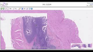 Histological description of the Ileum Peyers patches [upl. by Roane]