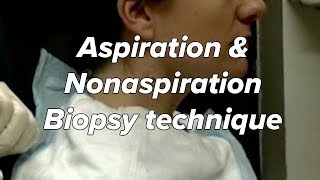 Aspiration amp Nonaspiration Zajdela technique  Biopsy Fine Needle Neck Mass [upl. by Attwood775]