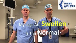 Swollen Legs Is That Normal After Surgery [upl. by Silverstein]