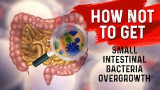 How to STOP Small Intestine Bacterial OvergrowthSIBO – Dr Berg [upl. by Merwyn376]