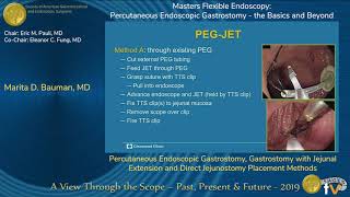 Percutaneous Endoscopic Gastrostomy Gastrostomy with Jejunal Extension [upl. by Harley]