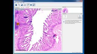 Module 4 Ileum with Peyers Patch [upl. by Adniroc383]